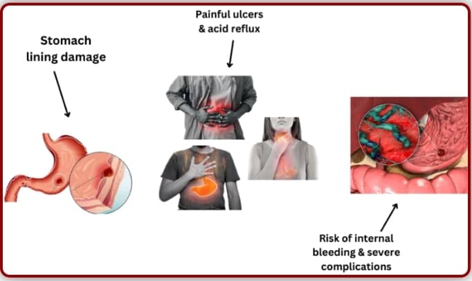 Before Using Arjuna & Lasuna